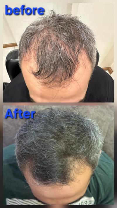 Exoluma before after.jpg